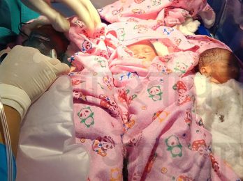 trio-baby-born-in-nepal